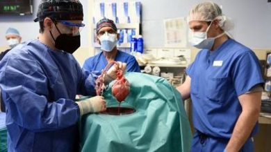 صورة فيديو.. زراعة قلب خنزير في جسم إنسان لأول مرة في التاريخ