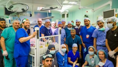 صورة أطباء سعوديون ينجحون في فصل توأمين يمنيين سیامیین