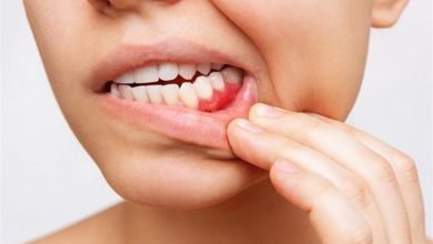 صورة 8 مشكلات صحية فى الفم تكشف عن أمراض السكرى والقلب