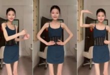 صورة “هيكل عظمي”.. فتاة صينية بالغة تزن 25 كيلو جرامًا وتصر على إنقاص وزنها