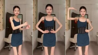 صورة “هيكل عظمي”.. فتاة صينية بالغة تزن 25 كيلو جرامًا وتصر على إنقاص وزنها