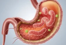 صورة 8 أطعمة تساعد في علاج جرثومة المعدة