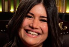 صورة قصة فنانة مصرية ضحية “الفيلر” و”التنمر”.. رحلة علاج مؤلمة استمرت 3 سنوات!