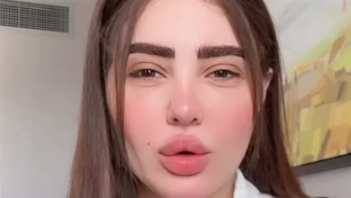 صورة زوجة المطرب مسلم ترد على البلوجر “أروى قاسم”.. “دي أعراض”