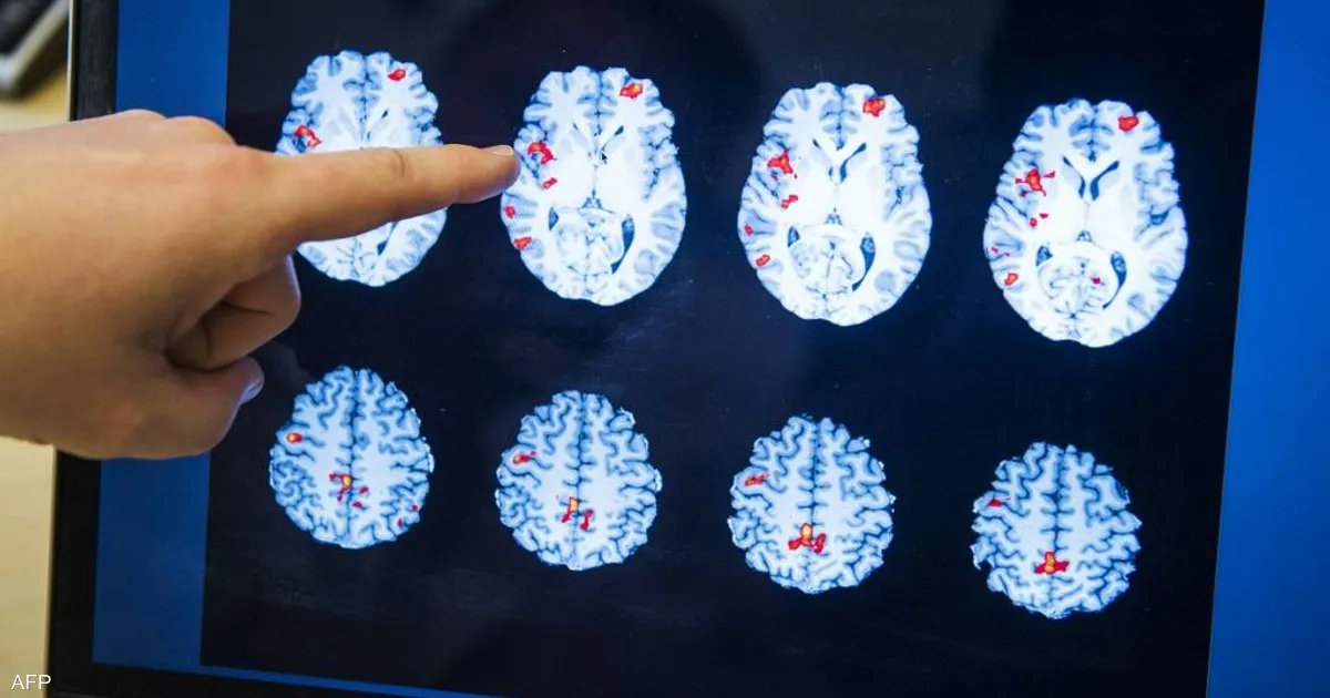 "إنجاز طبي في العلا.. إنقاذ كلية شابة بعملية نادرة تُجرى لأول مرة بالمحافظة"