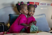 صورة ملحمة إنسانية في الرياض.. المملكة تبدأ أولى مراحل فصل التوأم السيامي الجامايكي «أزاريا وأزورا» في عملية معقّدة تمتد 9 ساعات