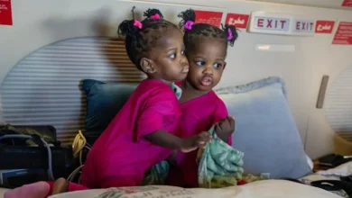 صورة ملحمة إنسانية في الرياض.. المملكة تبدأ أولى مراحل فصل التوأم السيامي الجامايكي «أزاريا وأزورا» في عملية معقّدة تمتد 9 ساعات