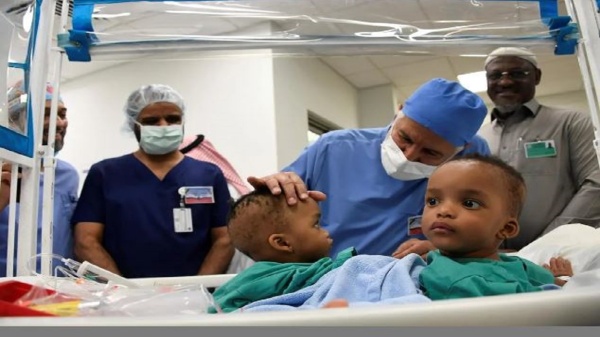 ملحمة إنسانية في الرياض.. المملكة تبدأ أولى مراحل فصل التوأم السيامي الجامايكي «أزاريا وأزورا» في عملية معقّدة تمتد 9 ساعات