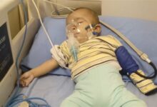 صورة “إنجاز طبي نادر في المدينة المنورة.. قسطرة تنقذ طفلاً من ضغط دم مزمن دون جراحة”