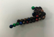 صورة عملية دقيقة في الدمام.. أطباء ينجحون في استخراج 49 مغناطيسًا من بطن طفل باستخدام المنظار