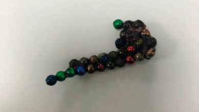 صورة عملية دقيقة في الدمام.. أطباء ينجحون في استخراج 49 مغناطيسًا من بطن طفل باستخدام المنظار