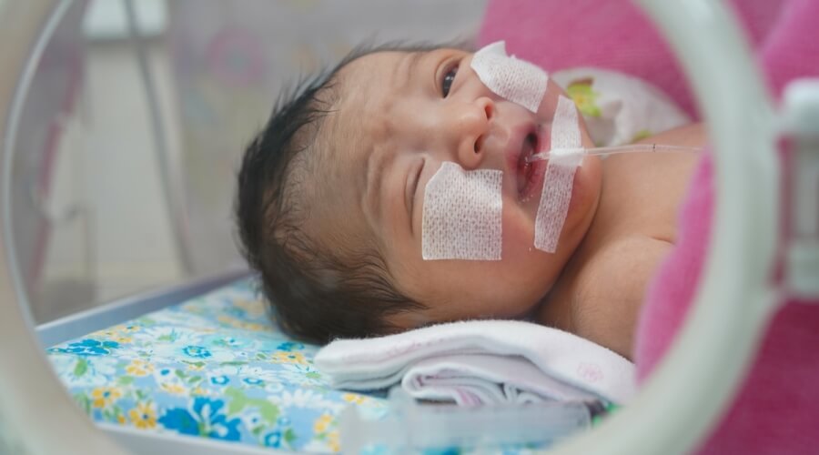 فريق طبي في جازان ينجح في استئصال تكيس رئوي ضخم من رضيع حديث الولادة… إنقاذ حياة يبدأ من غرفة العمليات ويعكس قفزات القطاع الصحي