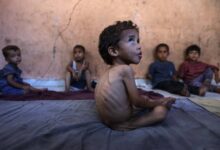 صورة يونيسف تدق ناقوس الخطر: 2025 الأسوأ في حياة ملايين الأطفال تحت وطأة الجوع والحروب