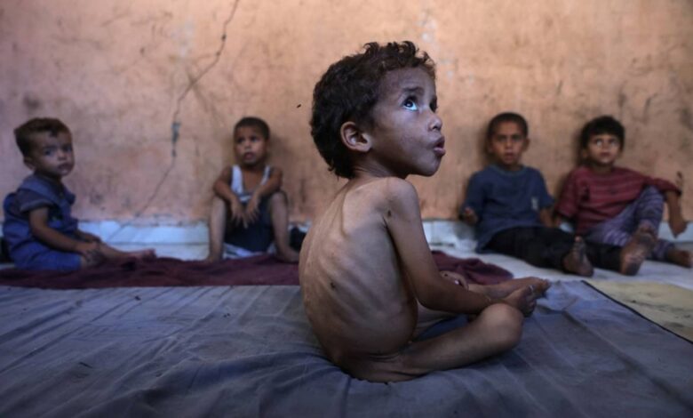 يونيسف تدق ناقوس الخطر: 2025 الأسوأ في حياة ملايين الأطفال تحت وطأة الجوع والحروب