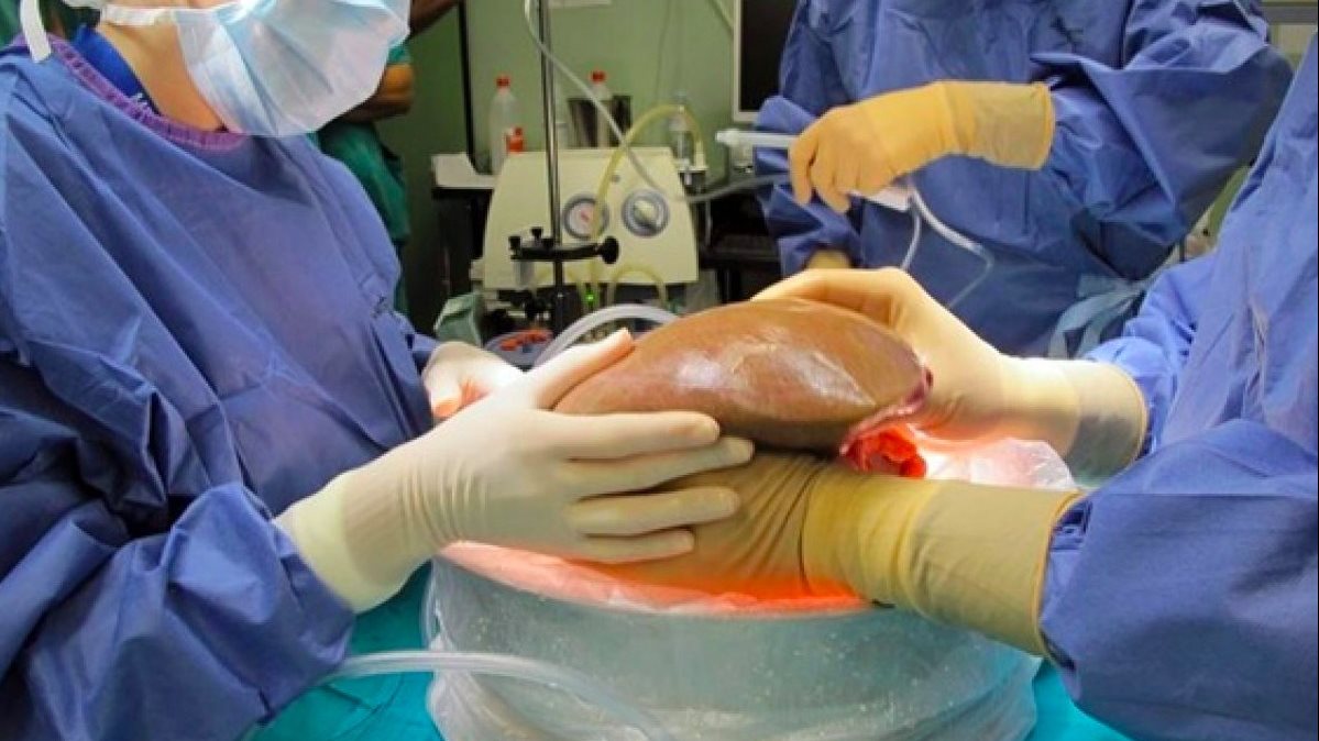 قصة تهزّ القلوب.. منال تهب طفلة حياة جديدة بعد تطابق نادر وفاجعة إنسانية