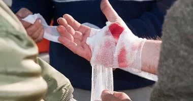 ثانية واحدة تفصل بين الحياة والموت.. ابتكار طبي يوقف النزيف فورًا