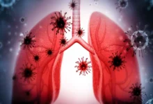 صورة التهاب الشعب الهوائية في الشتاء.. كل ما يجب معرفته عن المرض الأكثر انتشارًا في موسم البرد