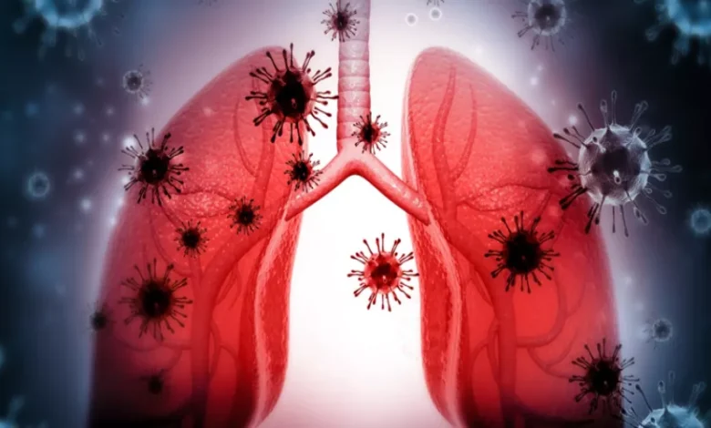 التهاب الشعب الهوائية في الشتاء.. كل ما يجب معرفته عن المرض الأكثر انتشارًا في موسم البرد