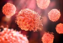 صورة موجة خرافات تربك الناس: العلم يكشف الحقيقة وراء أكثر الادعاءات رعبًا عن أسباب السرطان