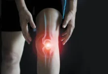 صورة بتقنية متقدمة تعيد الحركة من جديد.. مستشفى المانع ينجح في علاج حالة معقدة من خشونة الركبتين