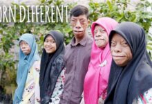 صورة «ملعونة بأرواح شريرة».. القصة الكاملة لعائلة وُصمت بوجوه السحالي قبل أن تكشف الحقيقة الصادمة