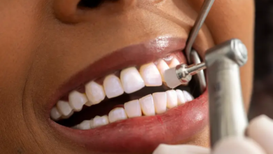 صورة نهج علمي جديد لمكافحة تسوس الأسنان عبر تعطيل تواصل البكتيريا