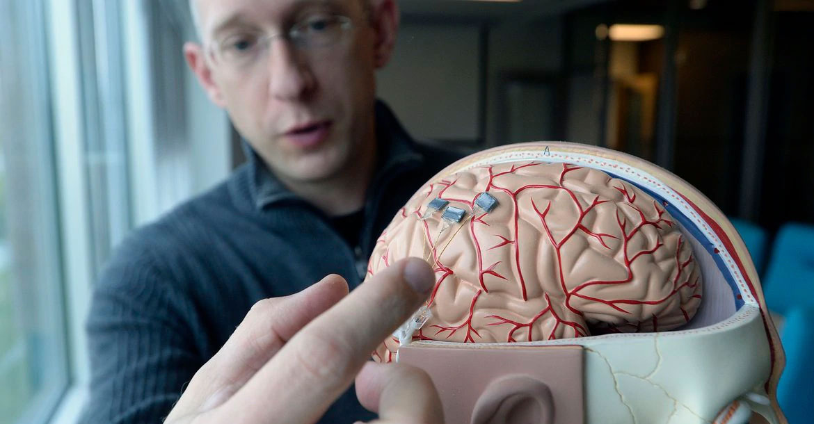 شريحة في الدماغ تغيّر حياة إنسان.. أول مزروع بشريحة عصبية يتحدث أمام قادة العالم